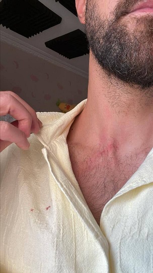 حمله زورگیران موتورسوار به مهاجم سابق استقلال در اتوبان شهید چمران/ عکس