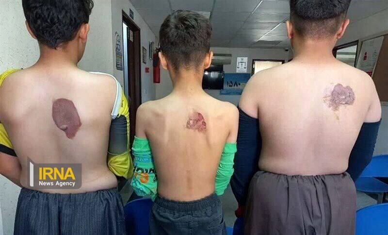تشکیل پرونده قضایی؛ سوزاندن بدن شاگرد خیاط با اتو
