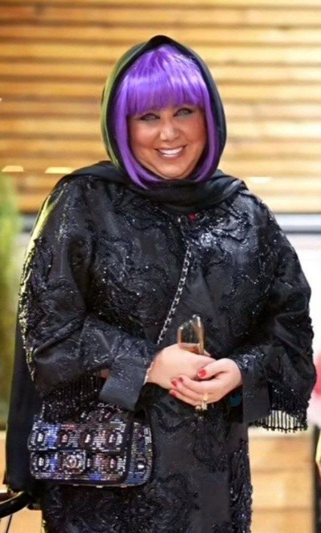 تغییر چهره عجیب بهنوش بختیاری سوژه فضای مجازی شد/ عکس