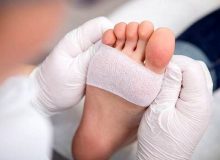 ابداع یک هیدروژل جدید برای درمان زخم‌های دیابتی