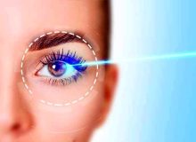 رقم های عجیب و غریب ایرانی ها برای عمل تغییر رنگ چشم