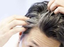 ویتامینی که کمبود آن سبب ریزش مو می‌شود