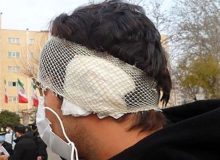 مرد ۵۰ساله با دندان گوش پسر جوان را در نانوایی ابوسعید کند