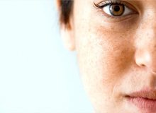 علت تیرگی پوست صورت چیست؟