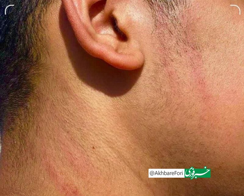 عزل معاون متخلف به‌ دلیل تنبیه دانش‌آموز/ عکس