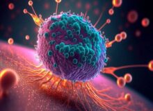 فروپاشی دژ نامرئی سرطان با فناوری نانوحباب