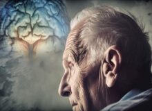 ارتباط سکته خفیف با افزایش ۳۴ درصدی زوال عقل در درازمدت
