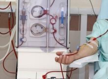 شناسایی زودهنگام خطر فیبریلاسیون دهلیزی با تغییرات چشم